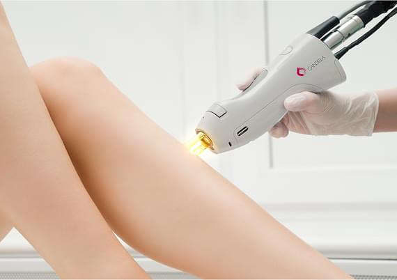 Pigmented Lesions Removal Pigmented Lesions Removal